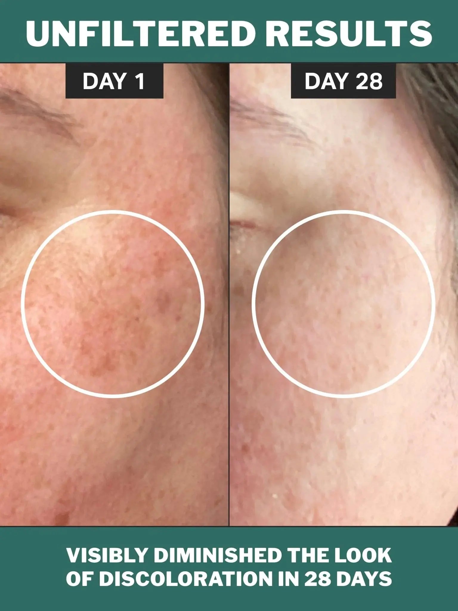 Chlorophyll discoloration serum - Sprig Beauty Co