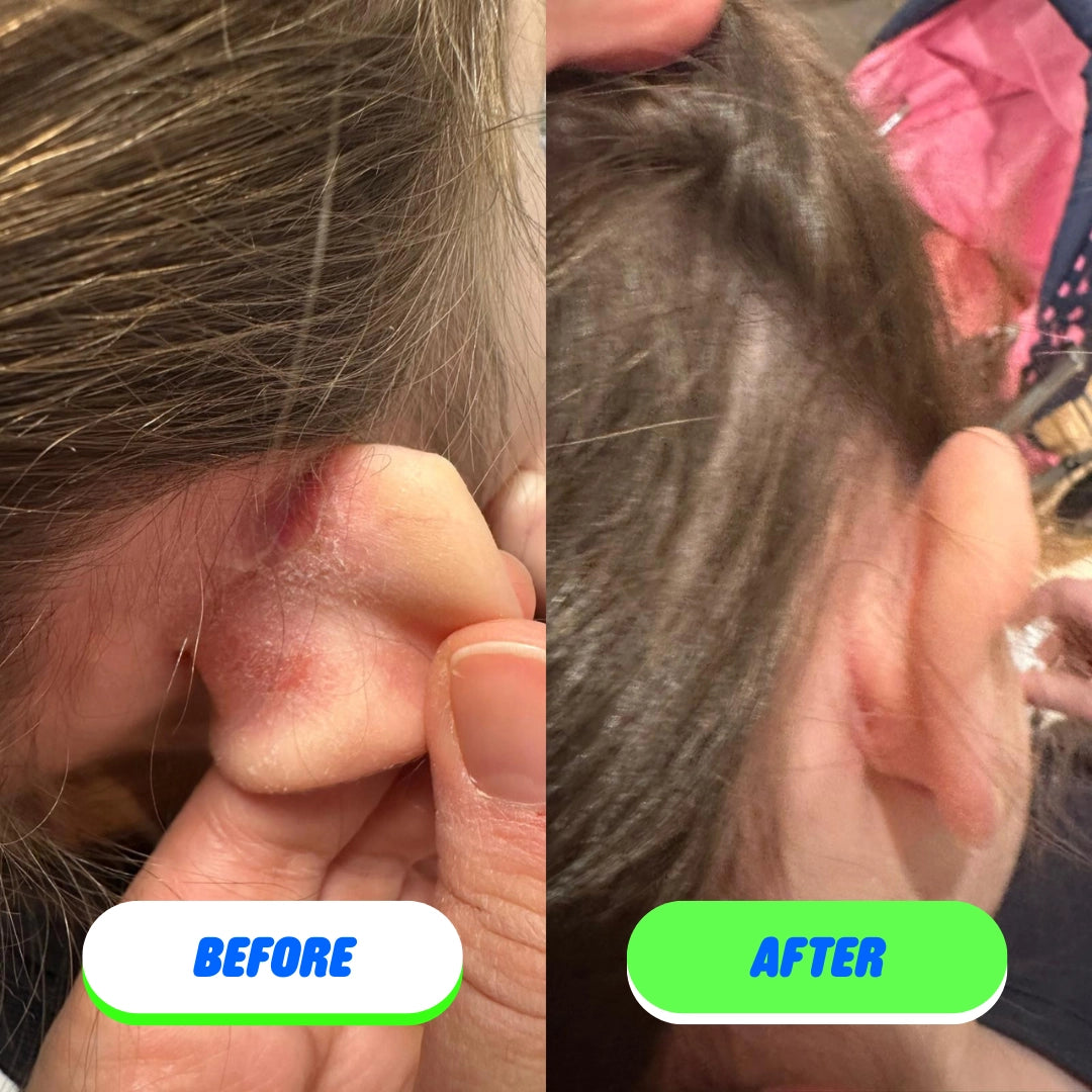 Pipa Skin Saver | Hypochlorous Acid Face and Body Spray - Sprig Beauty Co