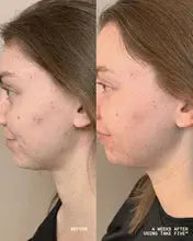 Take Five Hypochlorous Acid Spray
