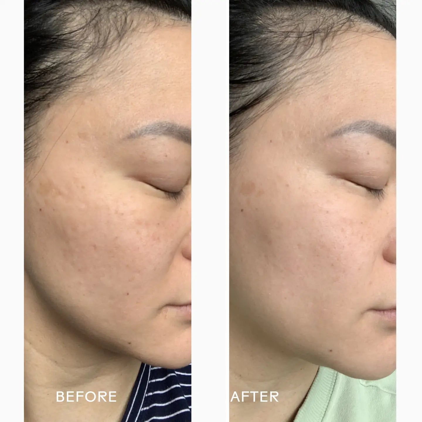 Grape Stem Cell & Squalane Ultra Hydrating Cream - Sprig Beauty Co