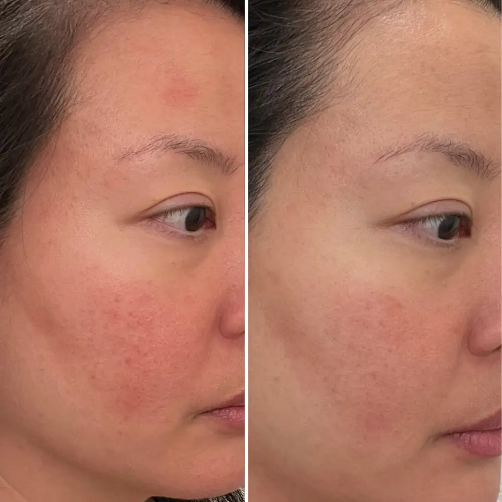 Ceramides & Blueberry Barrier Repair Serum - Sprig Beauty Co