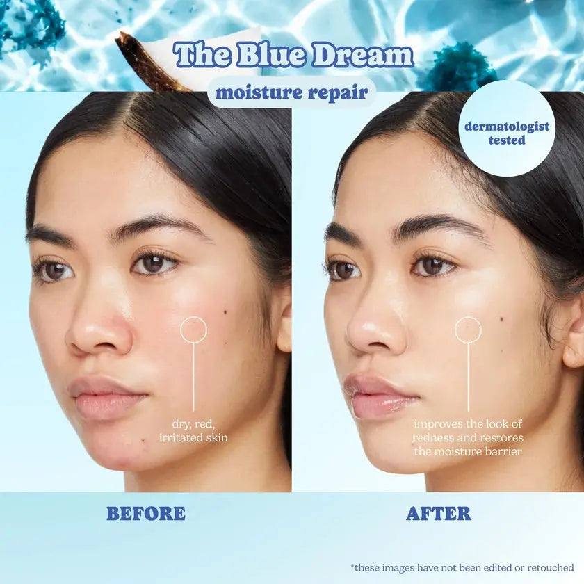 The Blue Dream Moisture Repair Sheet Mask