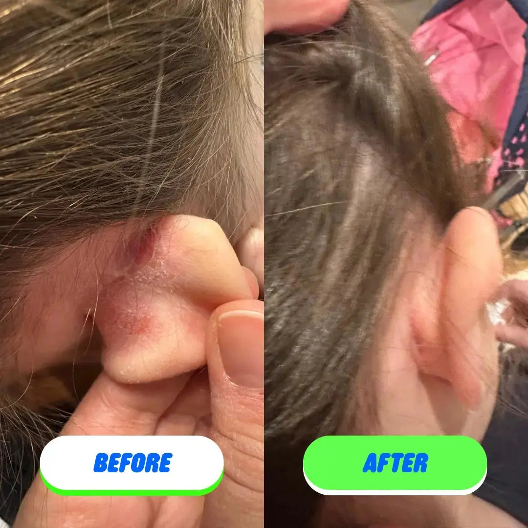 Pipa Skin Saver hypochlorous acid face and body spray in a clear spray bottle, designed for skincare and skin refreshment.