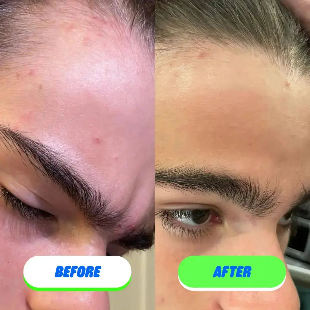 Pipa Skin Saver hypochlorous acid face and body spray by Pipa Skincare, in a clear spray bottle with a white cap.