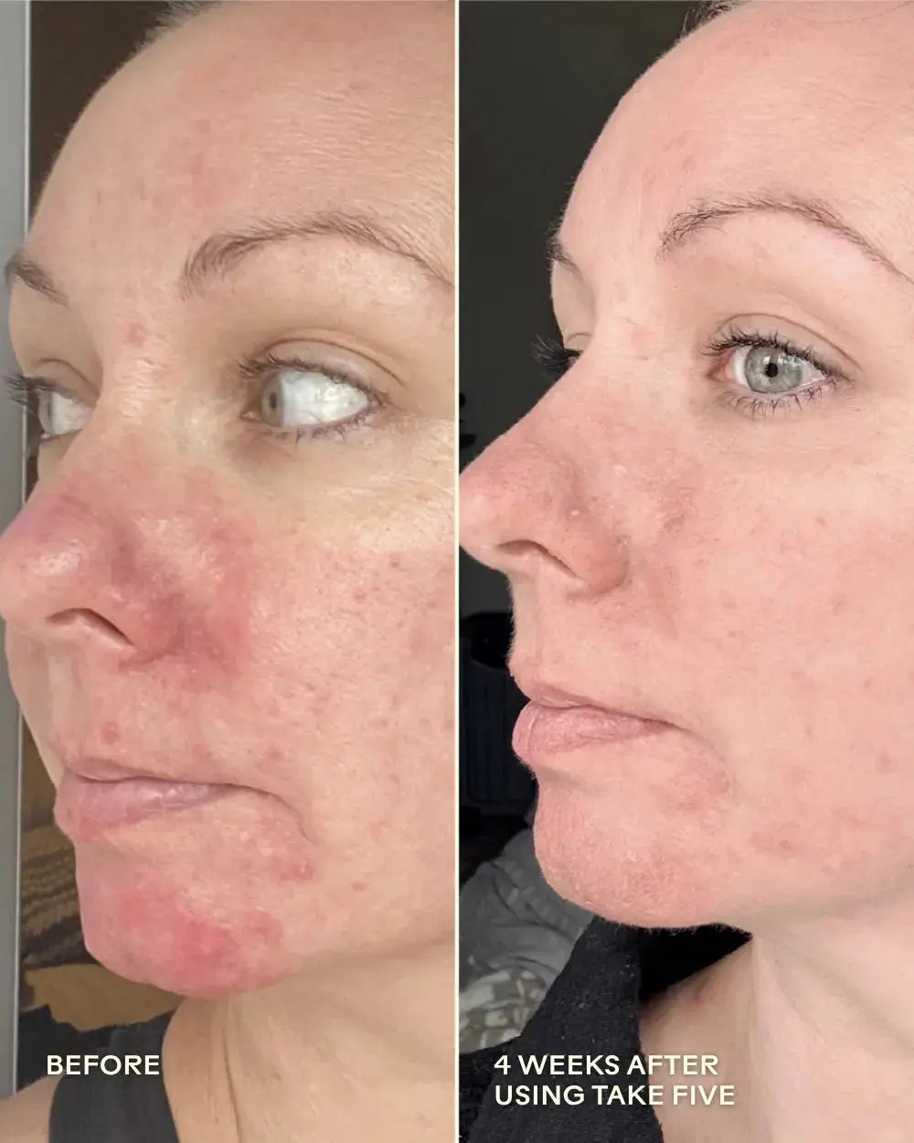 Three Ships Take Five hypochlorous acid skincare spray bottle